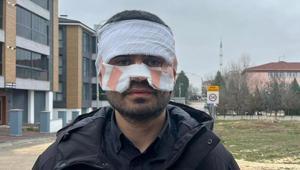 Öğretmen öğretmeni yaktı Lisede skandal olayda karar