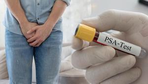 Sinsice ilerliyor, gençlerde de yaygınlaşıyor PSA testini ihmal etmeyin