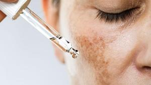 Her cilt sorununa aynı anda etki eden içerik: Azelaik asit ‘Çok yönlü çalışıyor