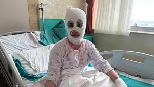 İftar vakti düdüklü tencere faciası ‘Yüzüme elimi sürdüm, et parçası geliyordu