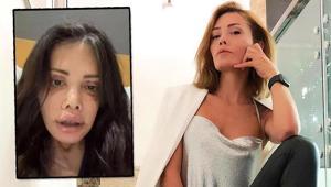 Didem Cerandan şoke eden paylaşım: Yüzü nakledilen kişinin alnı kaşıma denk geldi