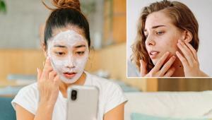Sosyal medyadaki cilt bakım trendlerine dikkat Sivilceleri artırıyor