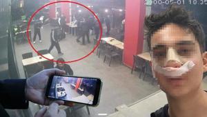 Akran zorbalığı kamerada Hiç tanımadıkları gencin yanına gelip burnunu kırdılar