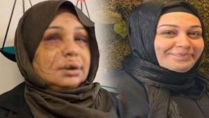 Eşinin yüzünü 60 dikiş atıldı Kendini böyle savundu: Ben büyük bir aile katliamını önledim