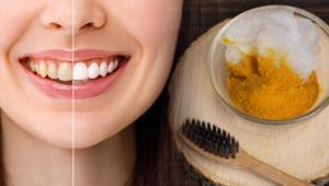 Hindistan cevizi yağına ekleyip macun yapın Dişleri beyazlatıp parlatıyormuş