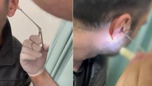 Şüpheli hareketleri dikkat çekmişti Kulağından çıkanlar şoke etti