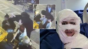 Kadıköyde genç kadını kolonya döküp yakan Sibel Arya Geriş nedenini anlattı