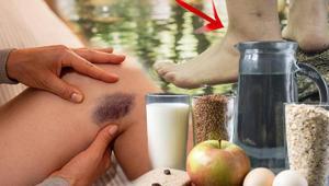 Gitmeyen kilo değil, doğrudan hastalık Milyonlarca kadında var, aynı bölgede yoğunlaşıyor