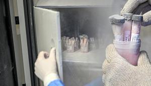 Ölenlerin sırt ve bacaklarından alınıyor Türkiyede bu merkezde saklanıyor... Detaylar ortaya çıktı