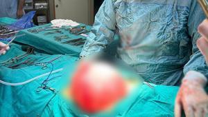 Kilo vermek için hastaneye gitti 14 yaşındaki çocuğun karnından çıkan şaşkına çevirdi