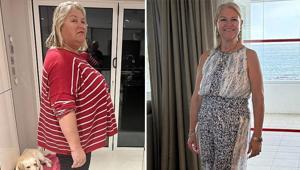 57 kilo verince derisi sarktı Çaresi bu yöntemde saklıymış, karnı artık dümdüz