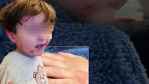 Özel kreşte skandal olay 2,5 yaşındaki çocuk darp edildi