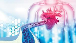 Test sistemi de değişiyor Kolesterol rehberi baştan yazıldı