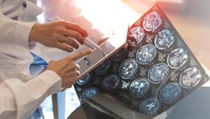 Saatlerce oturmak beyni sessizce tehdit ediyor Demans riskinde çarpıcı artış