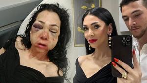 Hayatı bir günde değişti Kocaelide dehşeti yaşayan kadın konuştu: Asla eskisi gibi olamayacağım