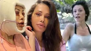 Yüz nakli olan Didem Ceran son halini paylaştı ‘Bebeksiliğim yapay zeka değil’