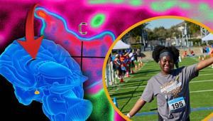 Koşarken başı ağrıdı, günlerce odadan çıkmadı Beynindeki tümör kanser değilmiş: Hayatını değiştiren teşhis