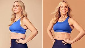 Sarkmış göbeğini hiç kilo vermeden 5 haftada eritti Yaşından daha genç görünüyor