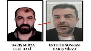 Ameliyat ile yüzünü değiştiren firari 7 yıl sonra yakalandı