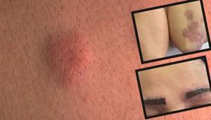 Popüler diye uyguladı kâbusu oldu Etkisi tüm vücuduna ince ince yayıldı