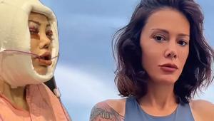 Didem Ceran yüz nakli sonrası son halini paylaştı: Bu bir estetik değil, yeniden doğuş