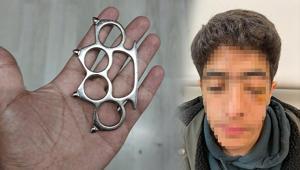 Esenyurt’ta akran dehşeti Gözünü kaybetme riskiyle ameliyata alınan çocuğun yüz kemikleri kırıldı