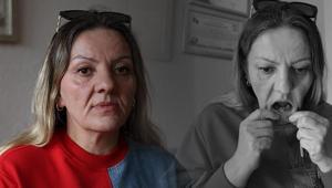 Deliller ağzında çakılı İspatlamak için iki yıldır yemek yiyemiyor