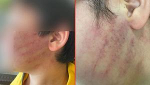 Sınıfta dehşet Okulda gelen 3 kişilik aile 2 çocuğu hastanelik etti: Panoya kafasını birkaç kere vurmuş