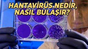 HANTAVİRÜS NASIL BULAŞIR, NASIL YAYILIR Hantavirüs insandan insana bulaşır mı, belirtileri nelerdir