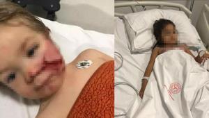 2 kardeşe saldırıp yaralayan pitbullun sahibi hakkında karar Çocuğumu mahvettiler