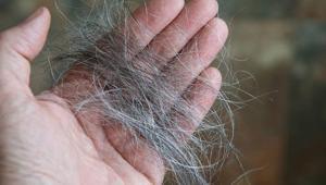 Kirli fırça yağın en büyük sebebi Sık temizlemeyince herkes aynı sorunu yaşıyor, dermatologlar uyardı