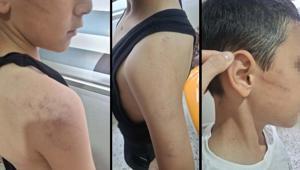 Manisada vicdanları sızlatan olay Öz babadan evladına şiddet; çocuk koruma altına alındı
