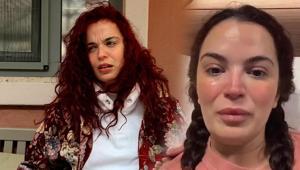 7 kez ameliyat olmuştu Aslı Bekiroğlunun başı beladan kurtulmuyor: Şimdi de ayağından sakatlandı