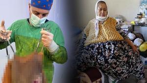 Karnından çıktı, doktorlar gözlerine inanamadı