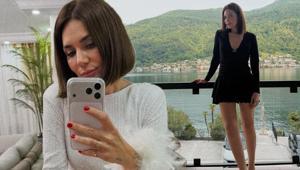 Buse Varol’dan ‘görünmez kaza’ paylaşımı Parmağı sargıya alındı
