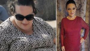 Hiç egzersiz yapmadı ama 89 kilo verdi Hayatımı değiştirdi