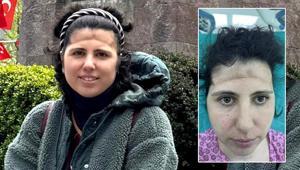 3 boyutlu teknoloji mucizesi Alnındaki çöküklük tarih oldu