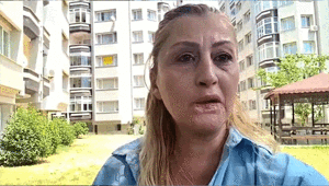 Dolgu yaptırdığı dudağı çürüdü Gülüşüm yok, yemek yemem problem