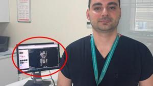 Zayıflamak uğruna kendine bunu yaptı İstanbulda doktorların inanamadığı vaka