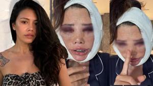 Korede yüz nakli olmuştu Survivor Didem Cerandan kölelik çıkışı