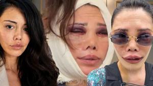 İkinci kez yüz nakli olmuştu Didem Ceran’dan peş peşe çarpıcı açıklamalar: Hiç kimsem yok, tek başıma savaşıyorum