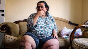 Fil hastası 3 çocuk annesi, tedavi olmak için yardım bekliyor: Yaralarda kurtlanma oluşuyor