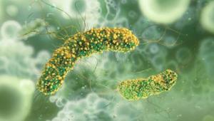 Peynirde ortaya çıkan Listeria bakterisi nedir, nasıl bulaşır Listeria Bakterisi belirtileri nelerdir, nelere dikkat etmek gerekir