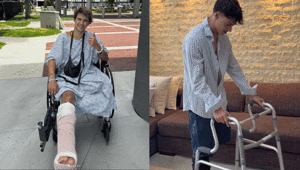 Bir bacağı ampute edilmişti Survivor yarışmacısı yeni ve zorlu hayatına alışmaya çalışıyor