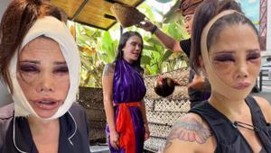 Yüz nakli hayatını kabusa çevirmişti Survivor Didem Cerandan arınma ritüeli