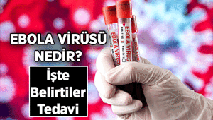 Ebola salgını nedir, nerede var Ebola virüsü belirtileri nelerdir, bulaşıcı mı, nasıl bulaşır
