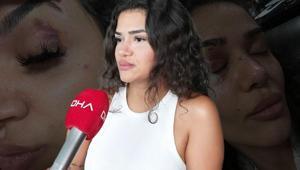 Kaçtı, uzaklaştırma kararı aldırdı yine de kurtulamadı Ebru hemşirenin kabusu: Benden kurtulmanın tek yolu beni öldürmen