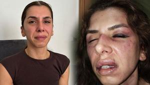 Eşi tarafından 4 saat işkence gördü, boğazına bıçak dayandı: Öldüm sandım ama bayılmışım