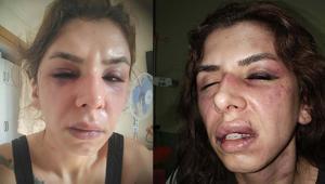 İstanbul’da dehşet Eşini saatlerce darbedip bıçakla tehdit ettiği iddiası: Şehadet getir