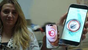 Doktor muayenede fark etti 10 yaşındaki çocuğun boğazından canlı sülük çıktı